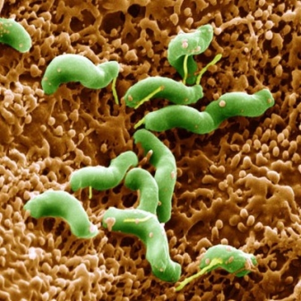 四大症狀當心幽門螺旋桿菌感染-兩類幽門螺旋桿菌檢測方法:三個方面預防幽門螺旋桿菌!