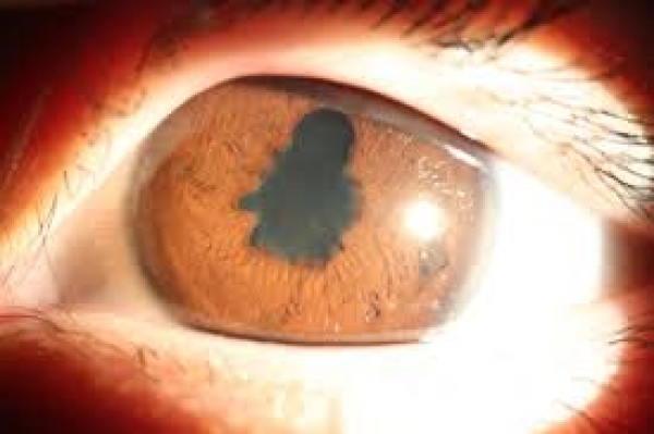 保養眼睛&amp;視力-保養眼睛三個問題&amp;護眼要素:正確保養眼睛預防眼疾風險!