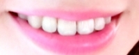 口臭&刷牙-四個消除口臭防治法:過度刷牙與漱口加速惡化口臭!