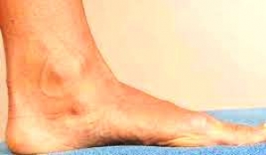 腳麻的五大原因及腳麻的危害-腳麻了怎麼辦&amp;腳麻的二大併發症:這樣做緩解腳麻危害消除腳麻木!