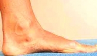 腳麻的五大原因及腳麻的危害-腳麻了怎麼辦&腳麻的二大併發症:這樣做緩解腳麻危害消除腳麻木!