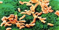 幽門螺桿菌&健康飲食-預防幽門螺桿菌四種食物的禁忌:幽門螺桿菌預防這些食物再美味也別吃!