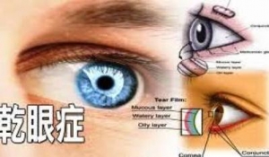 乾眼症症狀&amp;乾眼症異常的九大原因-六大乾眼症保養方法:做好生活對策乾眼症狀舒緩!